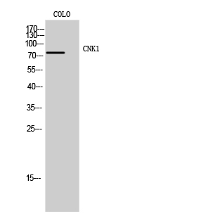 1 - CNK1 Polyclonal Antibody AP69181