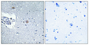 1 - CSGlcA-T Polyclonal Antibody AP69313
