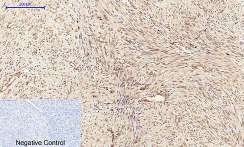 14 - Cyclin A Polyclonal Antibody AP69350
