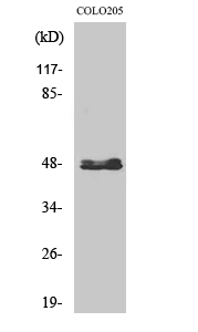1 - CYP11B1/2 Polyclonal Antibody AP69371