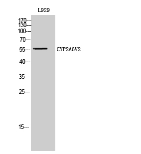 1 - CYP2A6V2 Polyclonal Antibody AP69389