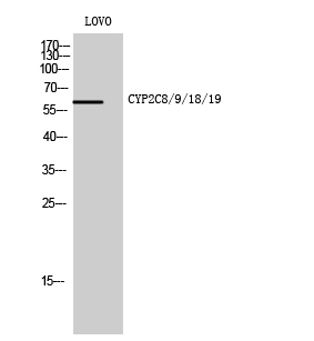 1 - CYP2C8/9/18/19 Polyclonal Antibody AP69396