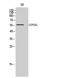 1 - CYP2E1 Polyclonal Antibody AP69403