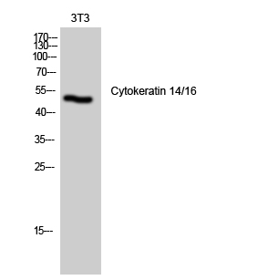 1 - Cytokeratin 14/16 Polyclonal Antibody AP69445