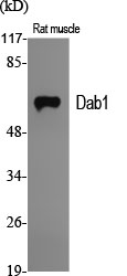 1 - Dab1 Polyclonal Antibody AP69465