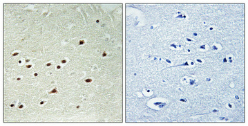 14 - DDX51 Polyclonal Antibody AP69497