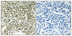 14 - DDX55 Polyclonal Antibody AP69500
