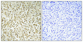 14 - DNA pol λ Polyclonal Antibody AP69561