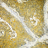 14 - Dynein LC 2 Polyclonal Antibody AP69615
