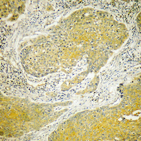 14 - Dynein LC 2 Polyclonal Antibody AP69615