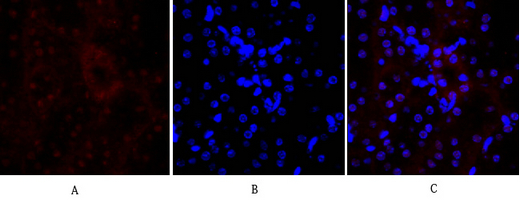 14 - E-cadherin Polyclonal Antibody AP69637