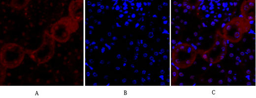 14 - E-cadherin Polyclonal Antibody AP69637