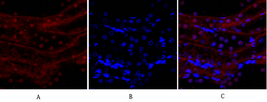 14 - E-cadherin Polyclonal Antibody AP69637