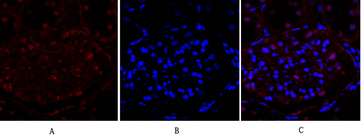 14 - E-cadherin Polyclonal Antibody AP69637