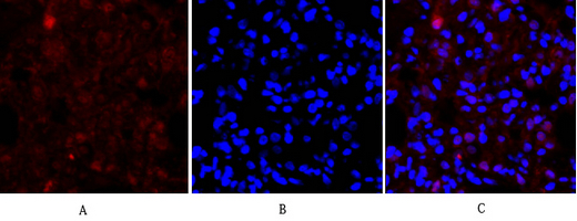 1 - E-cadherin Polyclonal Antibody AP69637