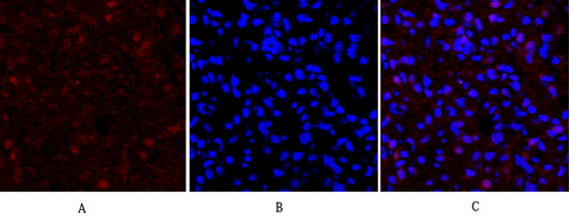 14 - E-cadherin Polyclonal Antibody AP69637