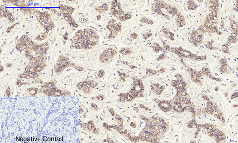14 - E-cadherin Polyclonal Antibody AP69637
