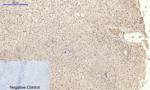 14 - E-cadherin Polyclonal Antibody AP69637