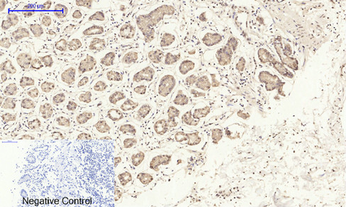 14 - E-cadherin Polyclonal Antibody AP69637
