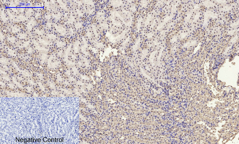 14 - E-cadherin Polyclonal Antibody AP69637