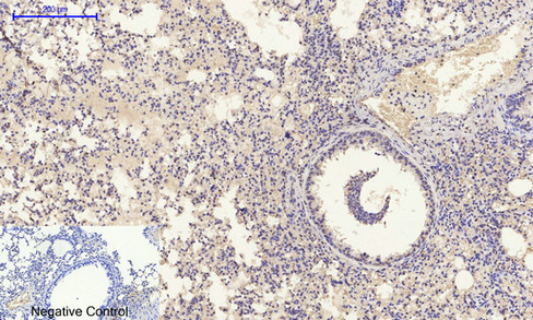 14 - E-cadherin Polyclonal Antibody AP69637
