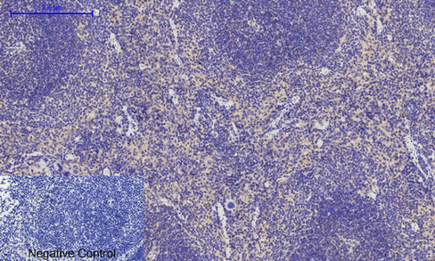 14 - E-cadherin Polyclonal Antibody AP69637
