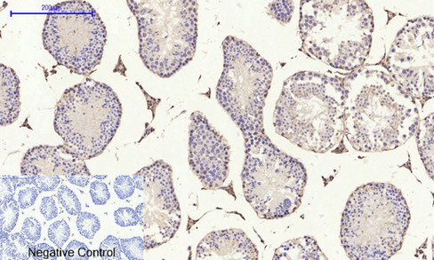 14 - E-cadherin Polyclonal Antibody AP69637