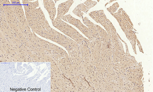 14 - E-cadherin Polyclonal Antibody AP69637