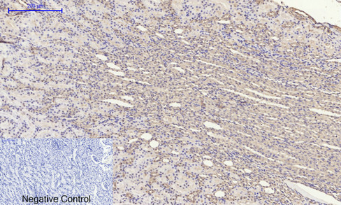14 - E-cadherin Polyclonal Antibody AP69637