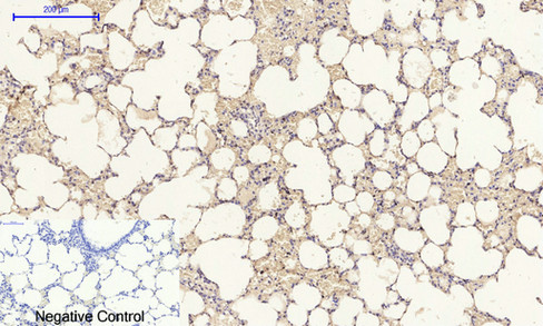 14 - E-cadherin Polyclonal Antibody AP69637