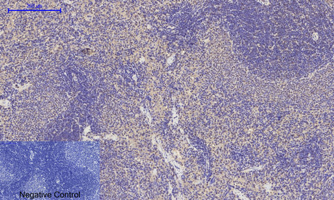 14 - E-cadherin Polyclonal Antibody AP69637