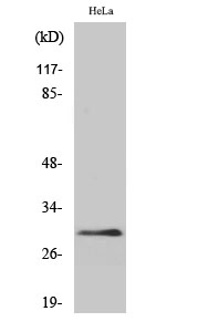 1 - eIF3K Polyclonal Antibody AP69693
