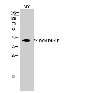 1 - EKLF/CKLF/UKLF Polyclonal Antibody AP69705