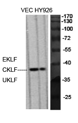 1 - EKLF/CKLF/UKLF Polyclonal Antibody AP69705