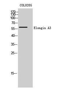 1 - Elongin A3 Polyclonal Antibody AP69717