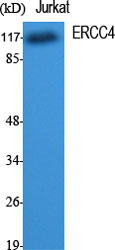 1 - ERCC4 Polyclonal Antibody AP69798