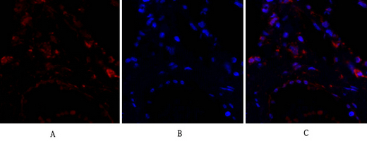14 - ERK 1/2 Polyclonal Antibody AP69808