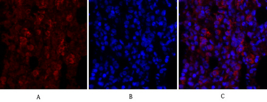 14 - ERK 1/2 Polyclonal Antibody AP69808