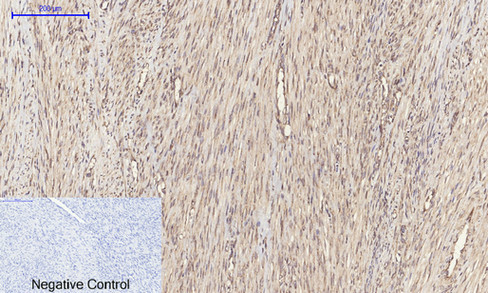 14 - ERK 1/2 Polyclonal Antibody AP69808