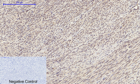 14 - ERK 1/2 Polyclonal Antibody AP69808