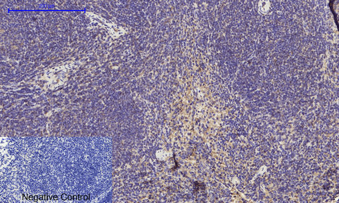 14 - ERK 1/2 Polyclonal Antibody AP69808
