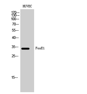 1 - FoxE1 Polyclonal Antibody AP69931