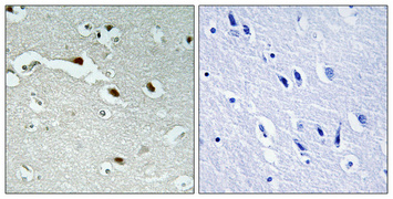 14 - FoxJ1 Polyclonal Antibody AP69934