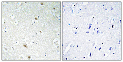 14 - FoxR1 Polyclonal Antibody AP69950