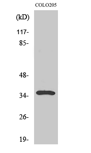 1 - Galectin-4 Polyclonal Antibody AP70021