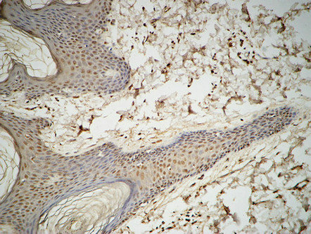 14 - GATA-2/3 Polyclonal Antibody AP70043