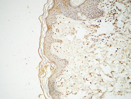 14 - GATA-2/3 Polyclonal Antibody AP70043