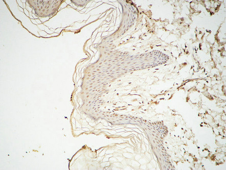 14 - GATA-2/3 Polyclonal Antibody AP70043