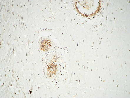 14 - GATA-2/3 Polyclonal Antibody AP70043