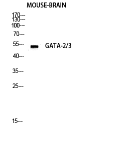 1 - GATA-2/3 Polyclonal Antibody AP70043